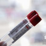 856 новых случаев инфицирования коронавирусом зафиксировано в Украине за сутки