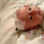 Двухмесячному мальчику из Кривого Рога собирают на лечение воспаления головного мозга